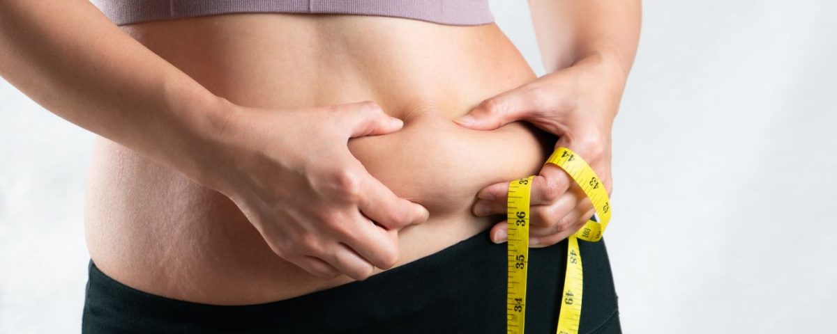 weight loss surgery excess skin