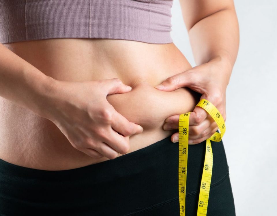 weight loss surgery excess skin